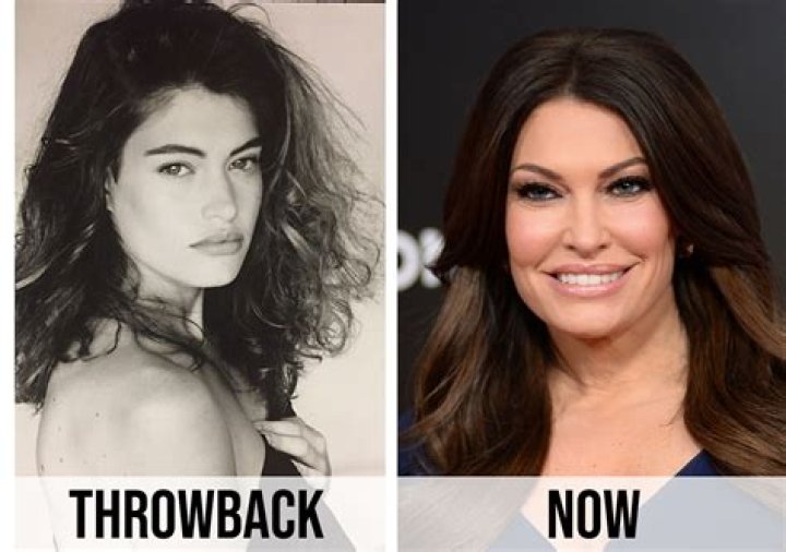 Kimberly Guilfoyle's Plastic Surgery Transformation: Unveiling the Truth