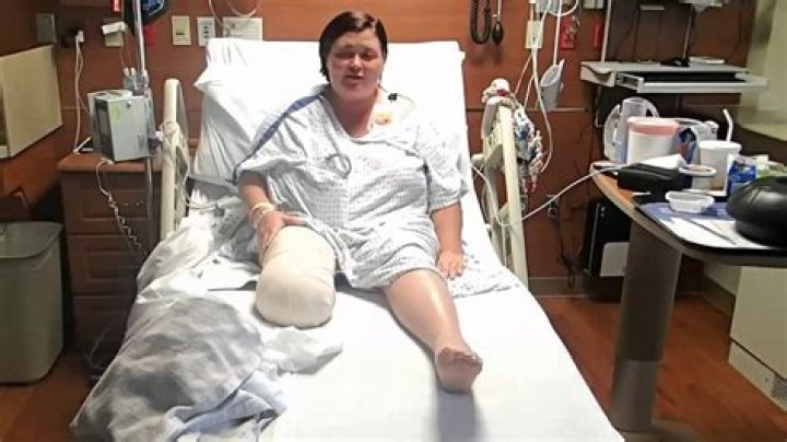 Richard Thomas' Journey: Overcoming Life After Amputation