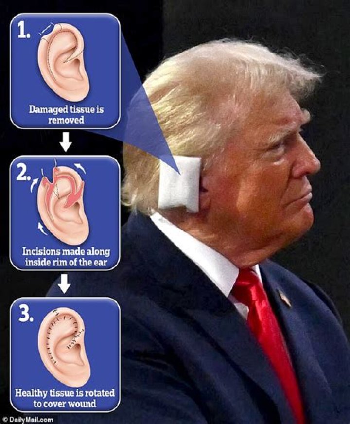 Trump's Ear Photo: The Unforgettable Image That Sparked Controversy